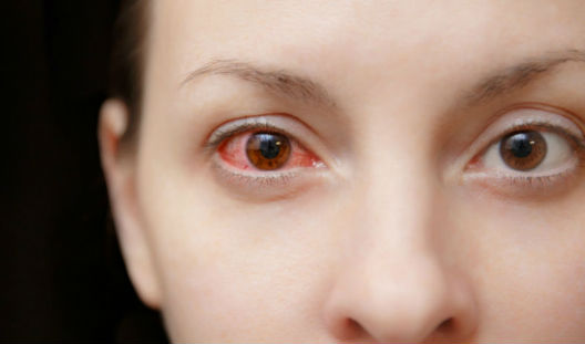 Enfermedades raras que afectan la visión