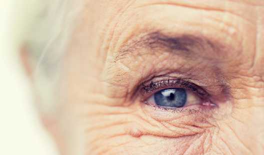 Preguntas frecuentes acerca del glaucoma