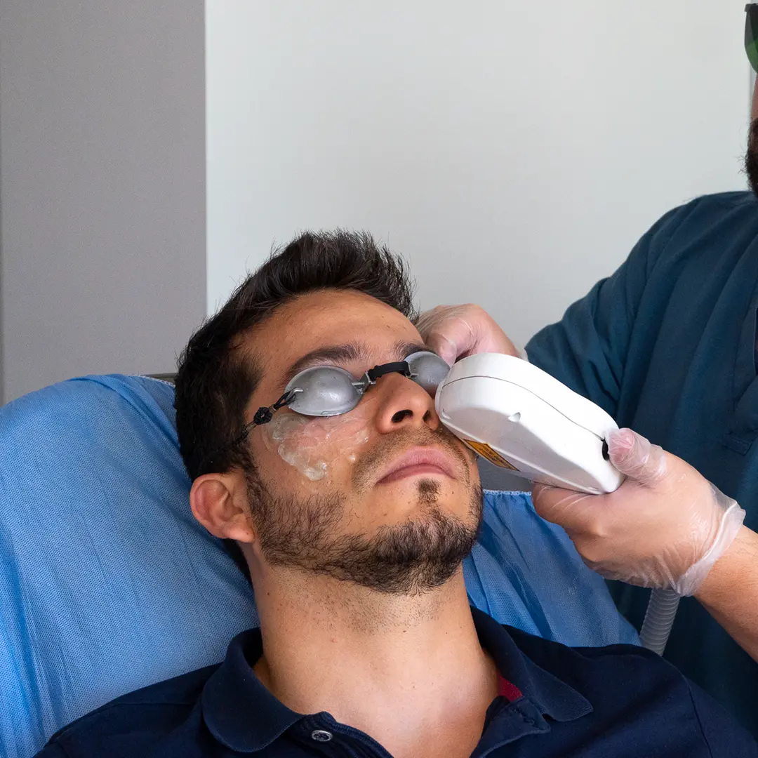 Tratamiento de ojo seco con tecnología IPL 