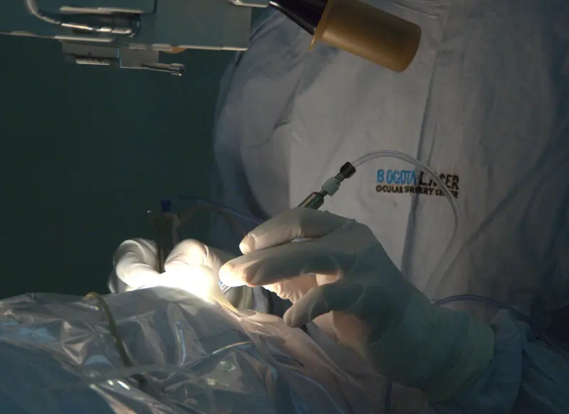 Principales cuidados antes y después de una cirugía de cataratas